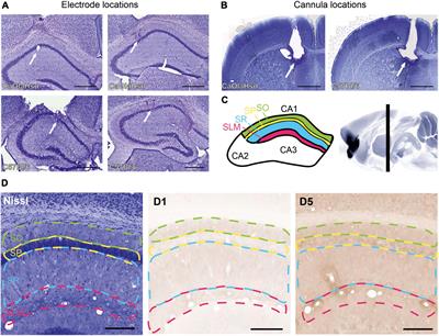 Strain-dependent regulation of hippocampal long-term potentiation by dopamine D1/D5 receptors in mice